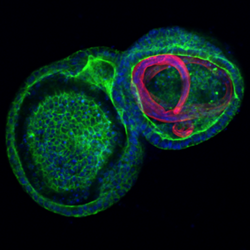 A parasitic worm taking up residence inside a miniature gut model