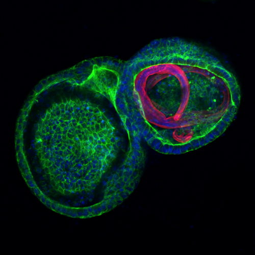 Lab grown mini-gut in green containing a parasitic gastrointestinal nematode in red