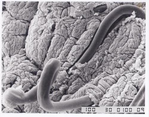 Roundworm