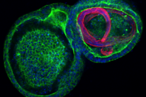A parasitic worm taking up residence inside a miniature gut model